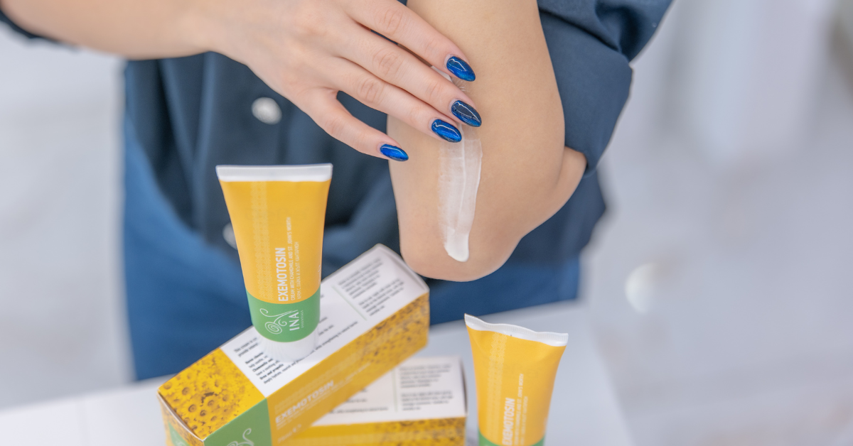 Sådan lindrer du hurtigt eksem: Brug denne naturlige creme med kamille og perikon