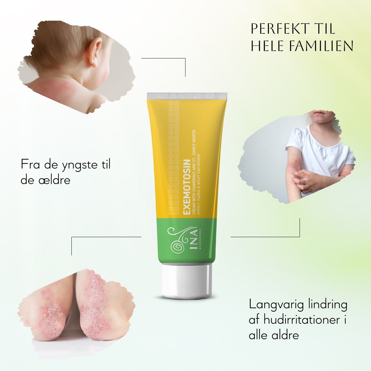 SÆRLIG ADGANG Creme til psoriasis, eksem og irriteret hud - med johannesurt, kamille og propolis