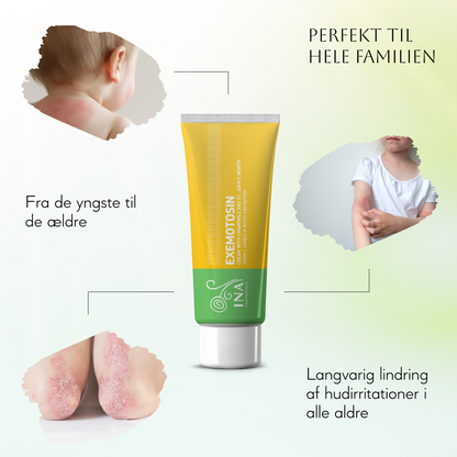SÆRLIG ADGANG Creme til psoriasis, eksem og irriteret hud - med johannesurt, kamille og propolis