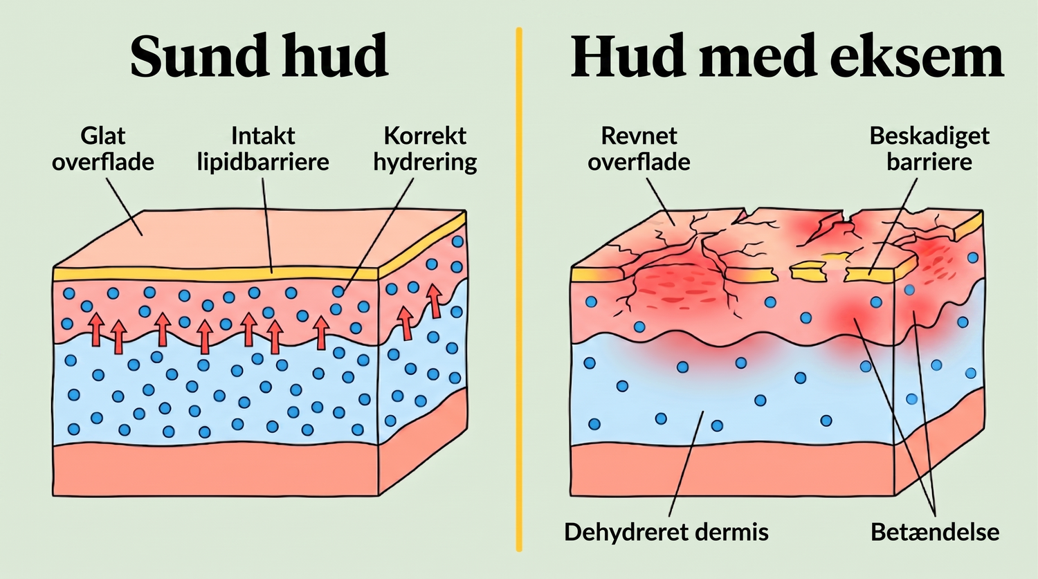 eczema_DK_skin_layers_v2.png