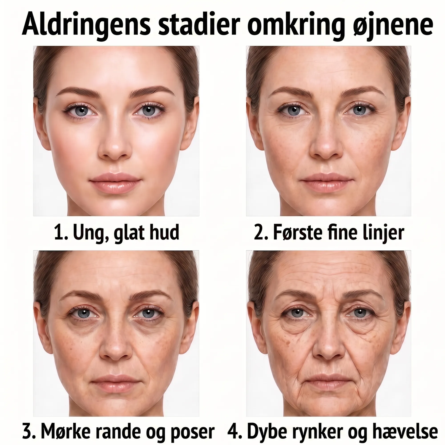Rose Eye Lift DK t15