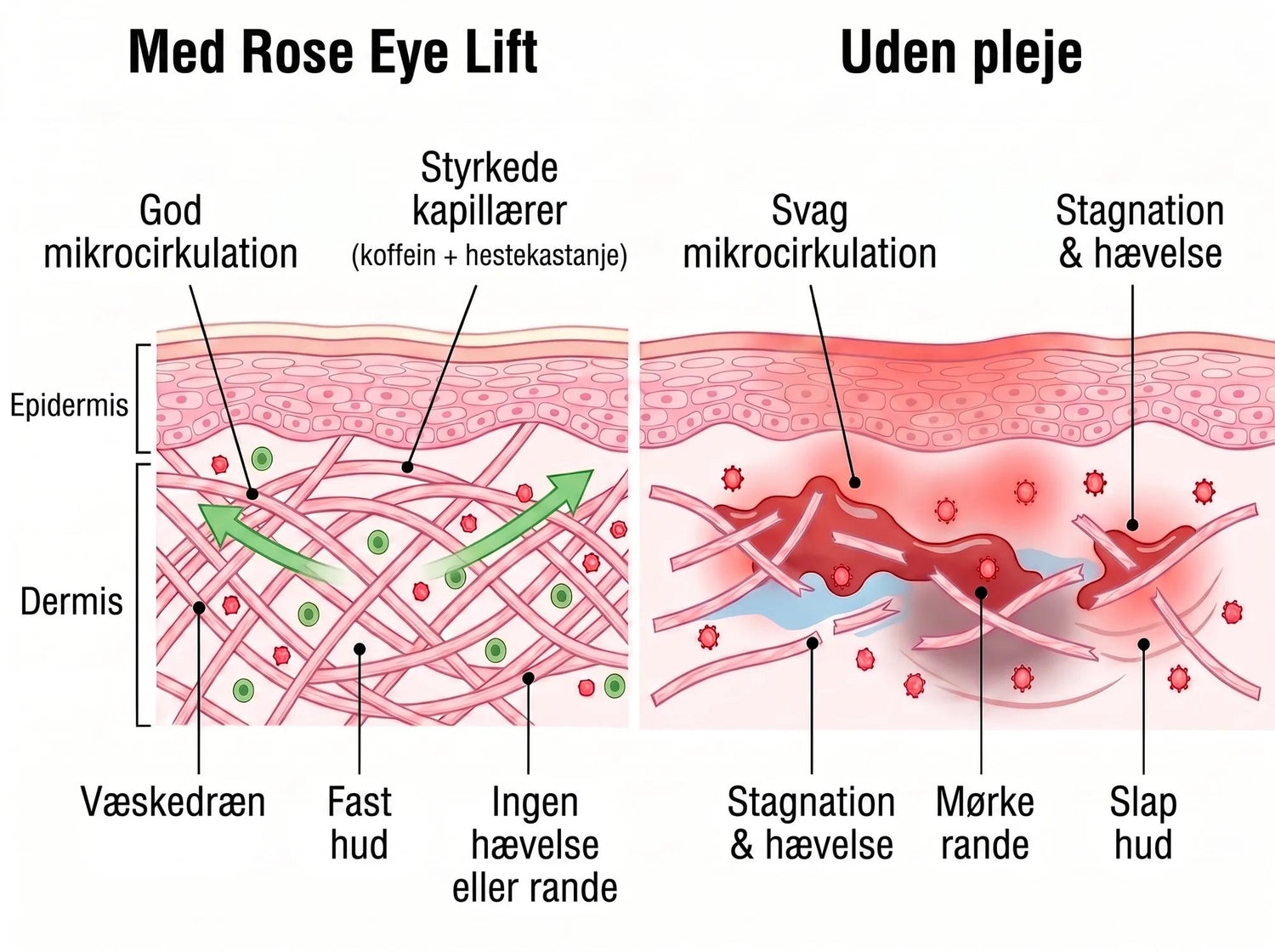 Rose Eye Lift DK t17
